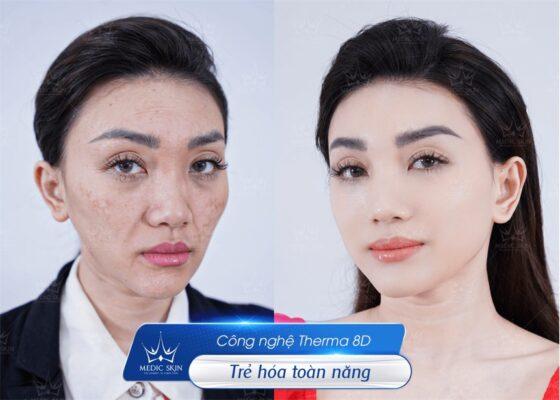 Sự thật đằng sau lời đồn Viện Thẩm mỹ Quốc Tế Medic Skin lừa đảo